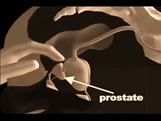 Técnicas De Masaje De Próstata